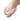 Varisan Small Bunion Hydrogel Protector